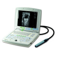 Scanner de ultra-som totalmente digital para laptop médico 2D